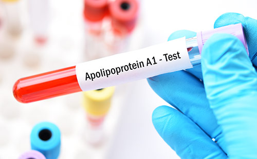 Stock photo illustrating research on chronic inflammation in people living with HIV
