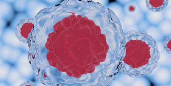 Stock photo illustrating stem cell transplant research toward a potential HIV cure
