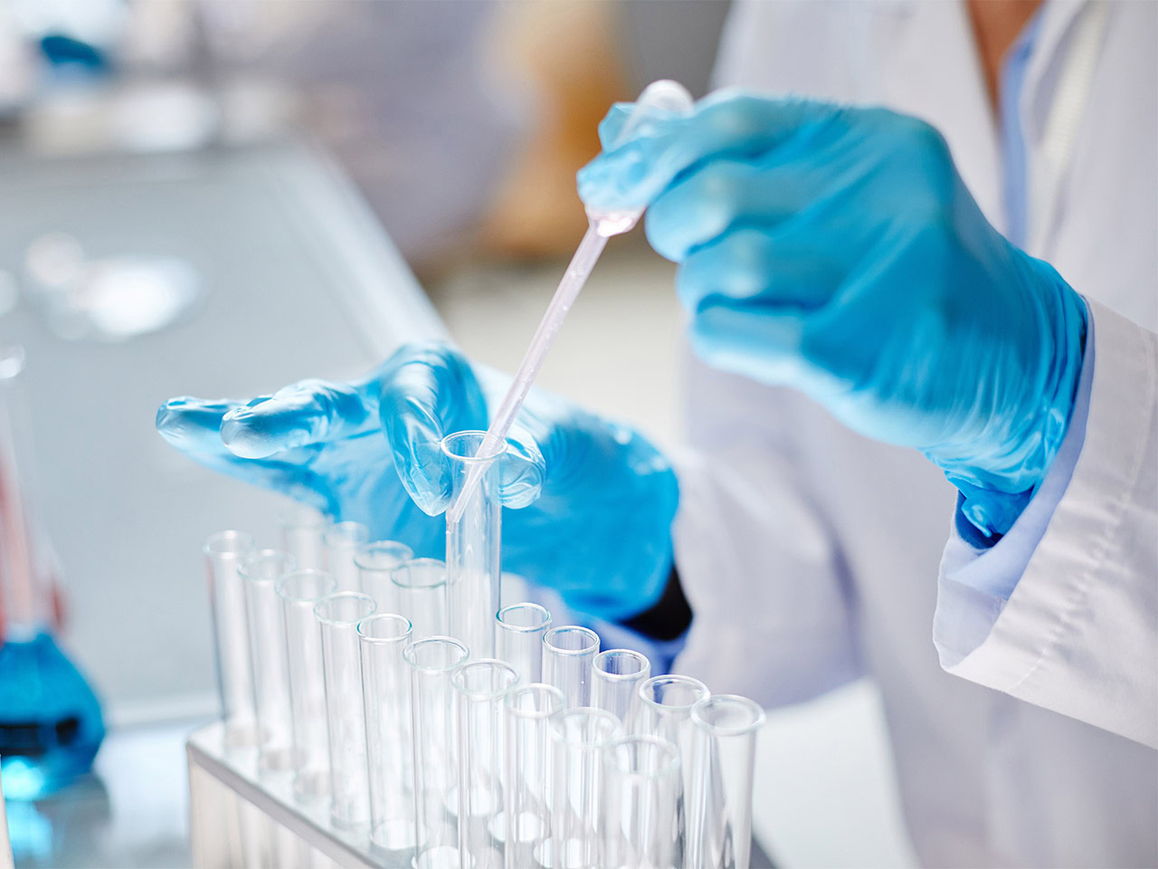 Scientist handling test tube with pipette in HIV research lab.