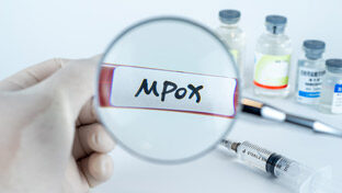 Mpox-Image_312x176_program_0901234