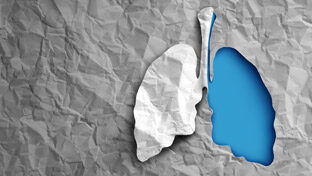 TB and HIV: A Deadly Duo